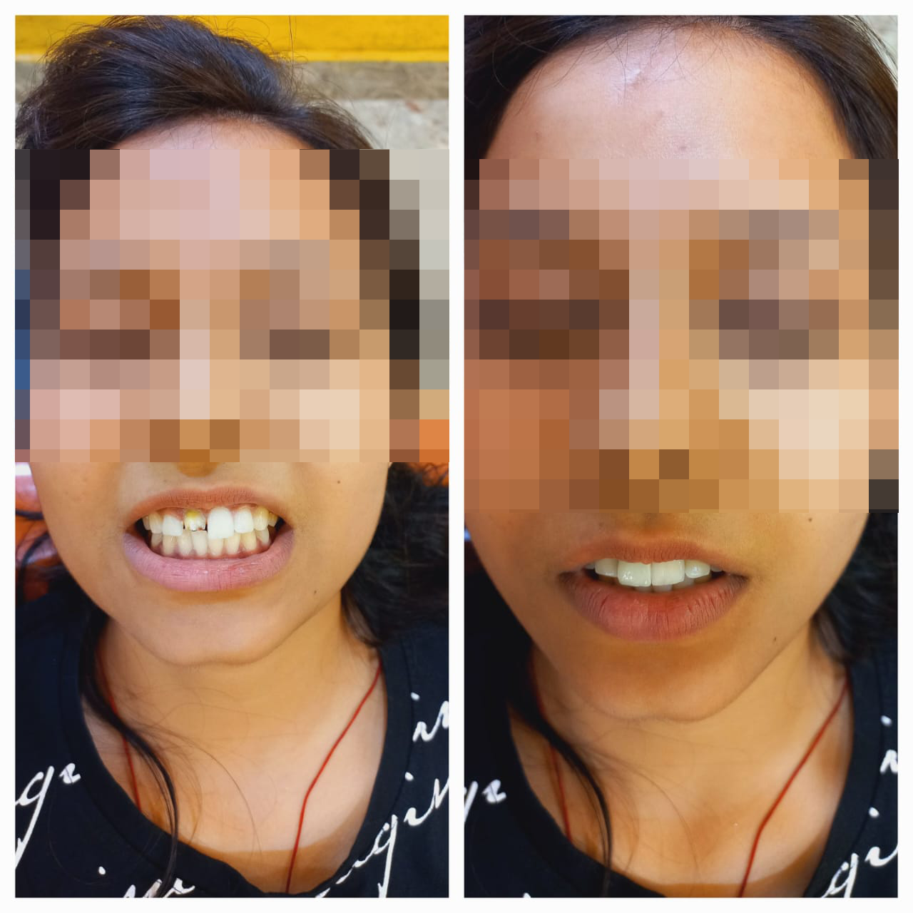 rishi dental care gallery 1