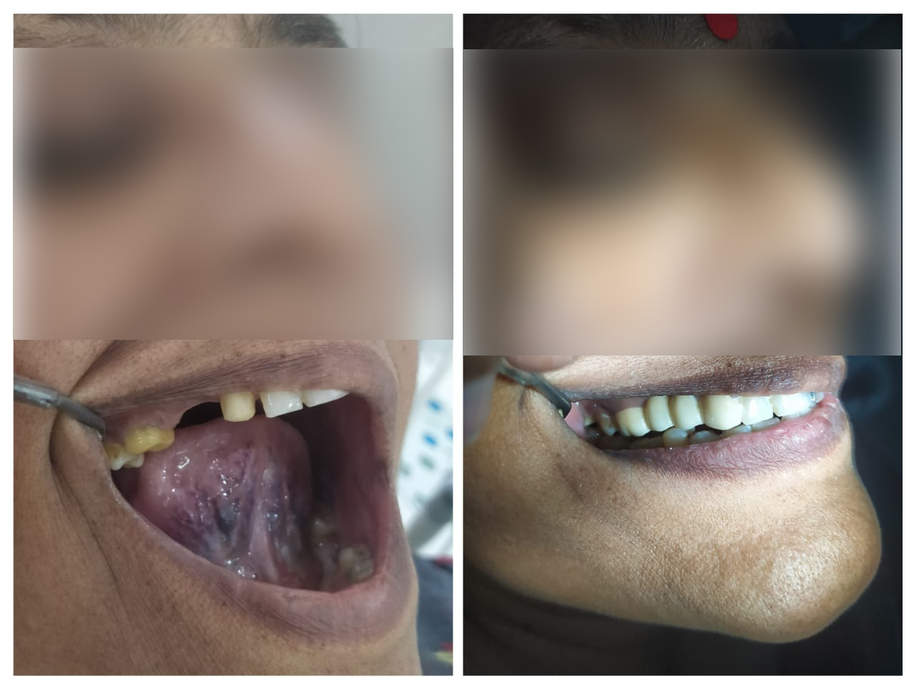 rishi dental care gallery 10