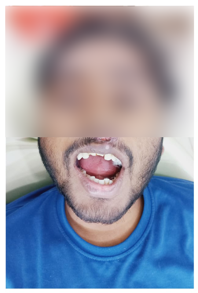 rishi dental care gallery 11