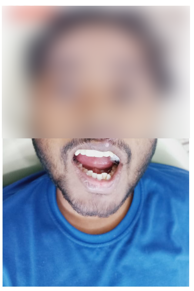 rishi dental care gallery 12