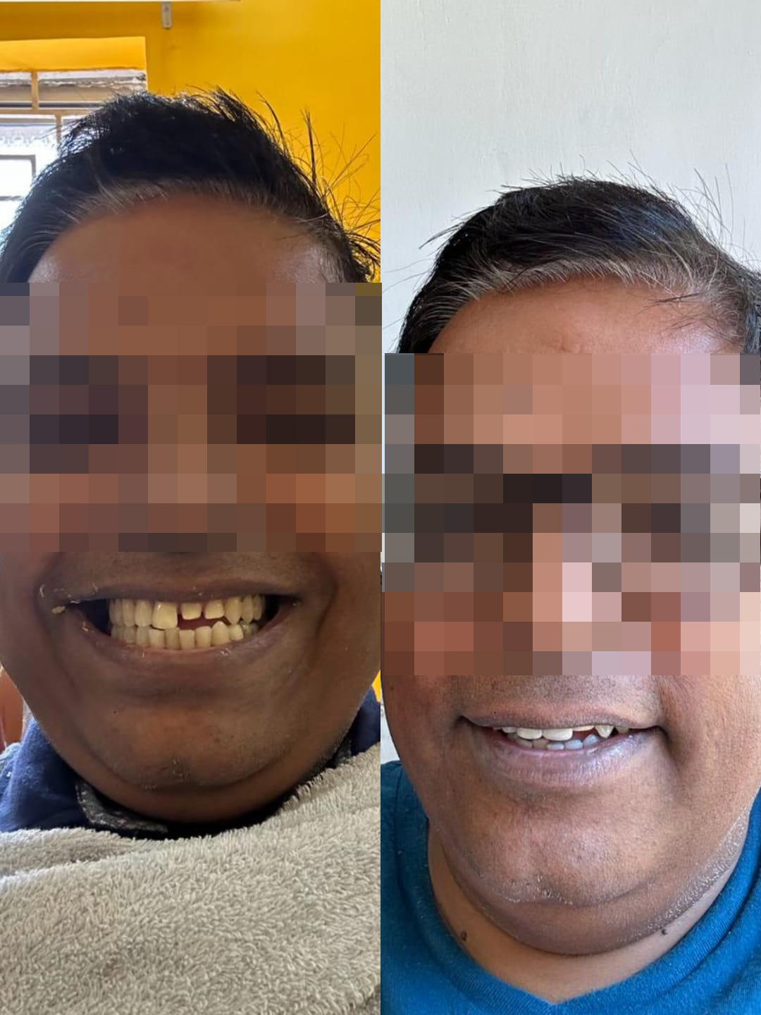 rishi dental care gallery 2