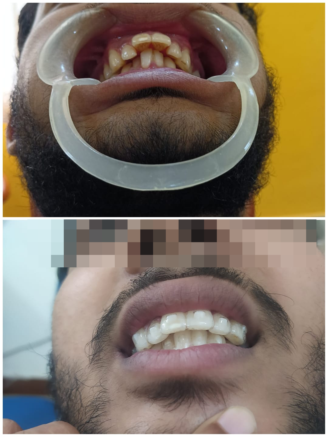 rishi dental care gallery 3