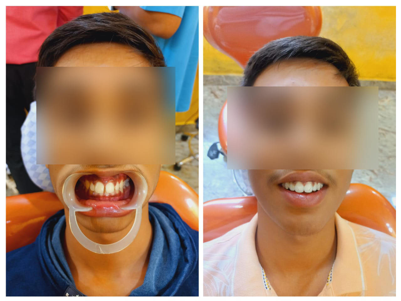 rishi dental care gallery 4