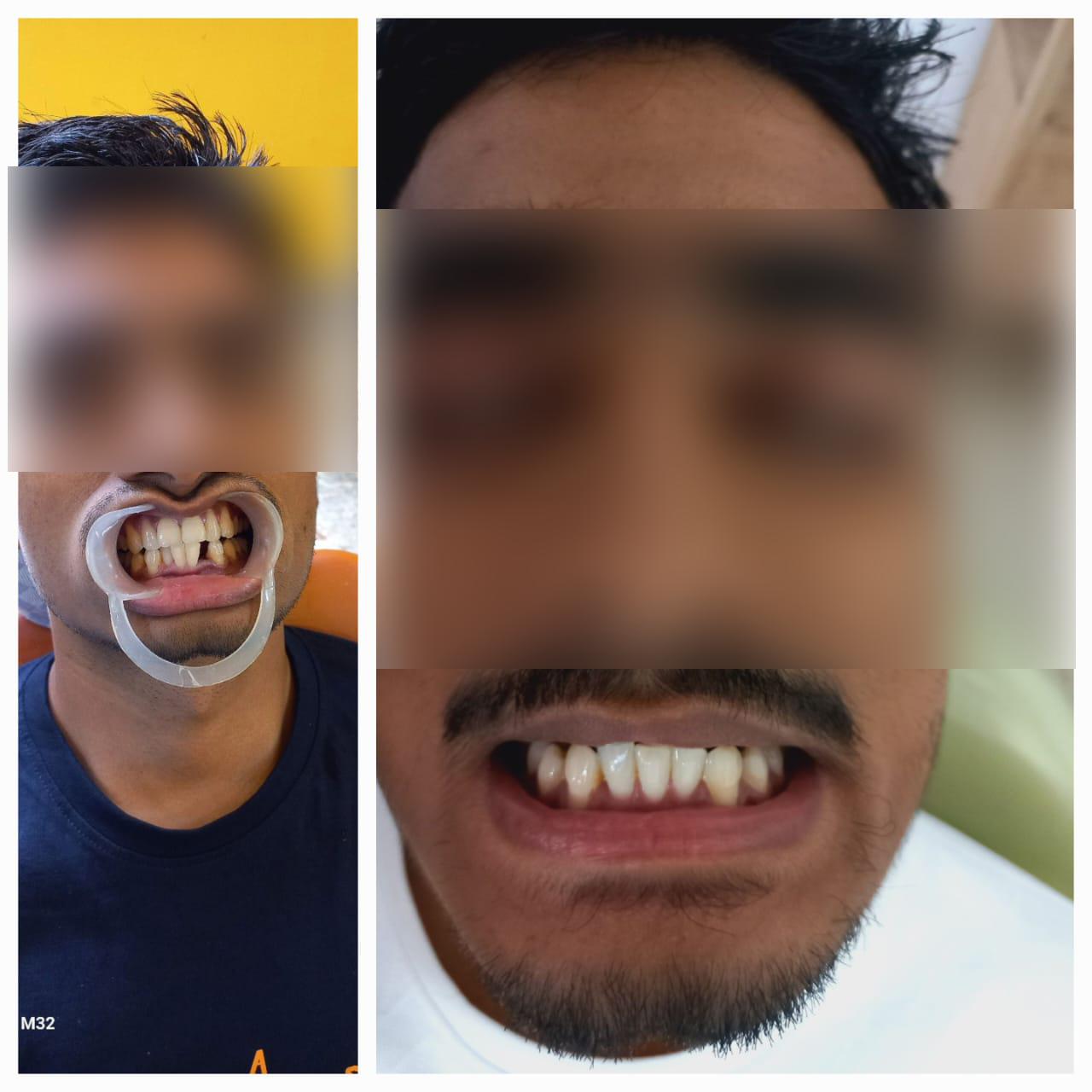 rishi dental care gallery 5