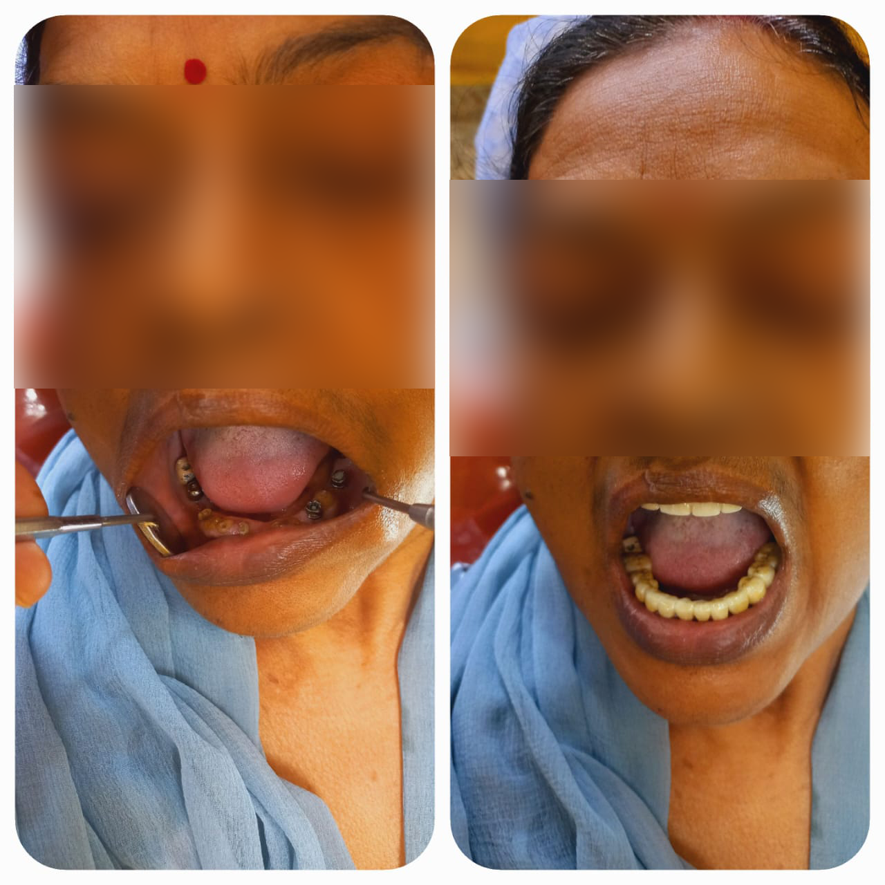 rishi dental care gallery 6