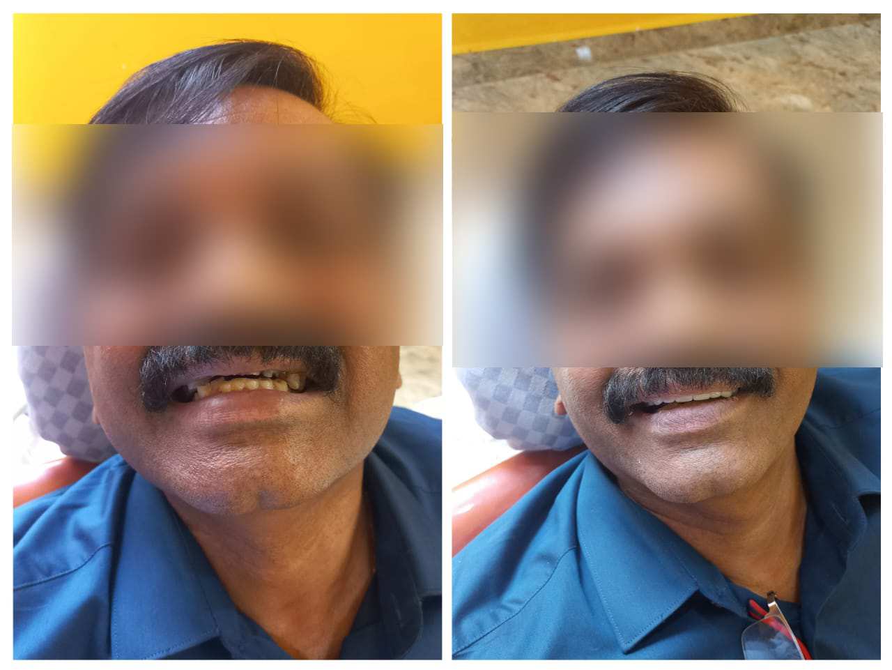 rishi dental care gallery 7