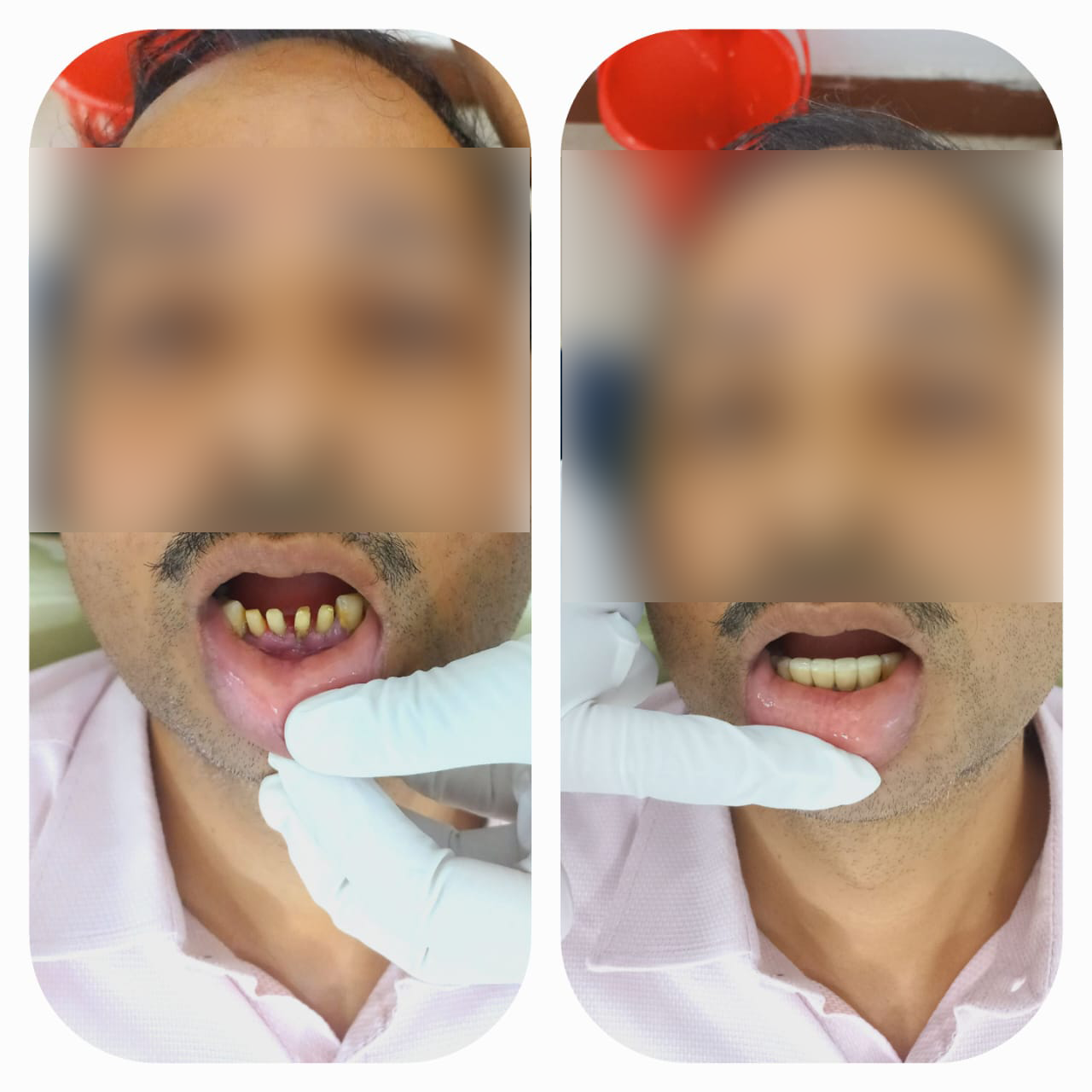 rishi dental care gallery 8