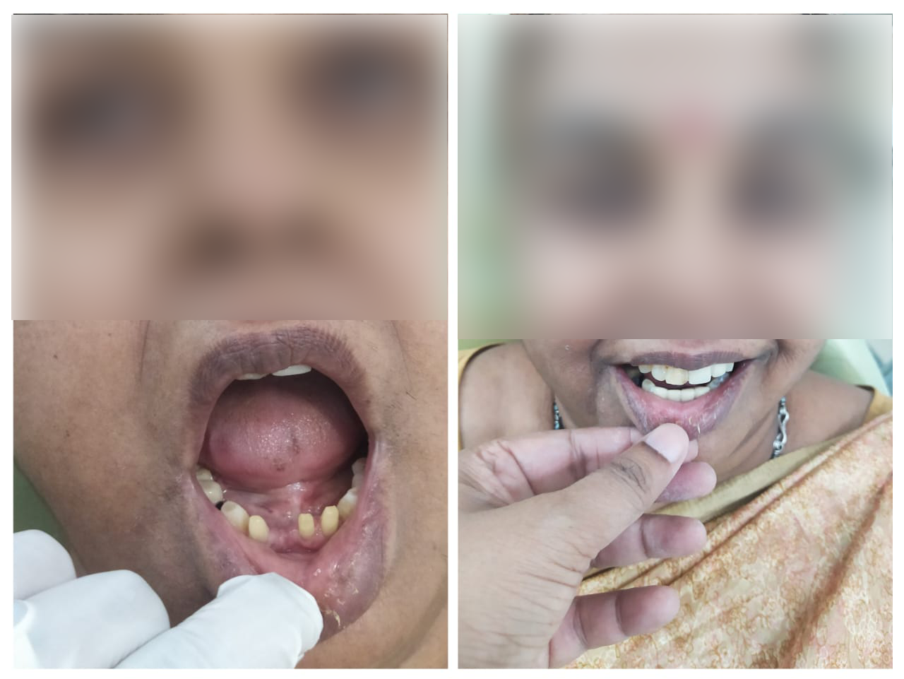 rishi dental care gallery 9